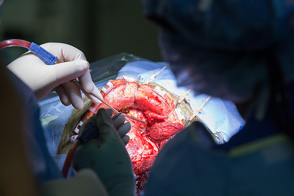 SLU_Neurosurgery_Feb2016_419