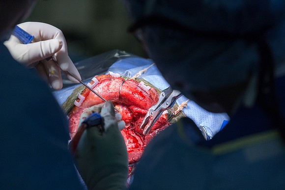 SLU_Neurosurgery_Feb2016_424