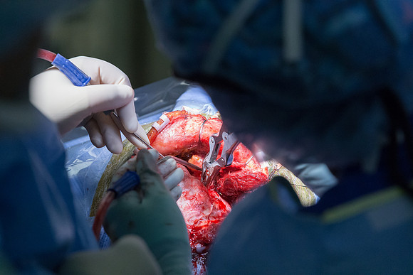 SLU_Neurosurgery_Feb2016_416